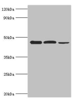Western blot. All lanes: Eukaryotic initiation factor 4A-I antibody at 3ug/ml. Lane 1: K562 whole cell lysate. Lane 2: Hela whole cell lysate. Lane 3: Rat brain tissue. Secondary. Goat polyclonal to rabbit IgG at 1/10000 dilution. Predicted band size: 47, 40 kDa. Observed band size: 47 kDa.
