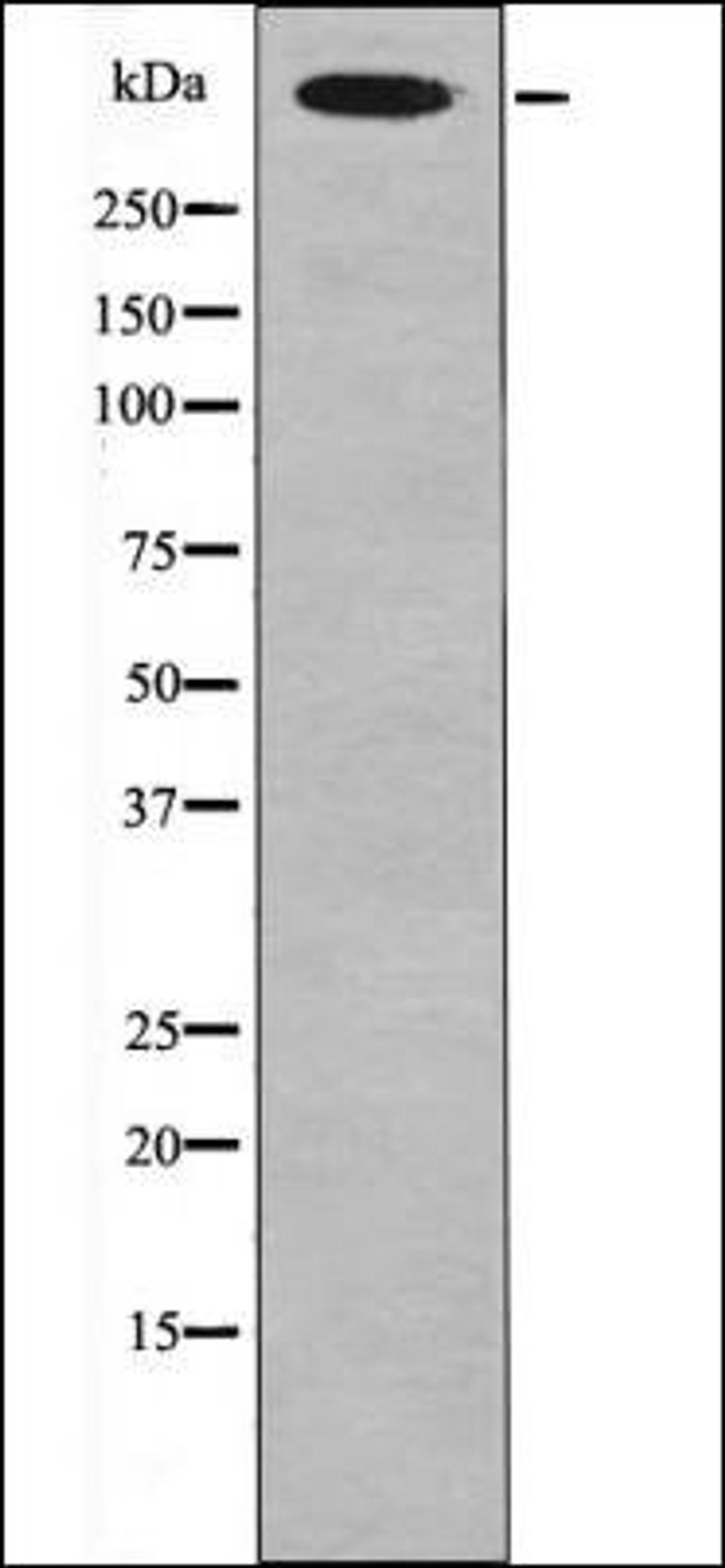 Western blot analysis of UV treated HeLa whole cell lysates using Desmoyokin -Phospho-Ser5782- antibody