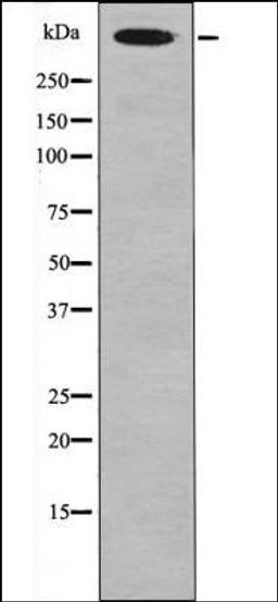 Western blot analysis of UV treated HeLa whole cell lysates using Desmoyokin -Phospho-Ser5782- antibody