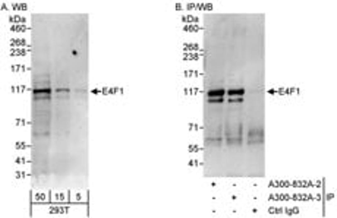 Detection of human E4F1 by western blot and immunoprecipitation.