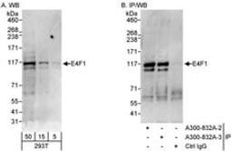 Detection of human E4F1 by western blot and immunoprecipitation.