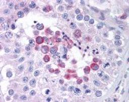 Immunohistochemistry staining of MAGEA3 in testis (formalin-fixed paraffin embedded) tissue using MAGEA3 Antibody.