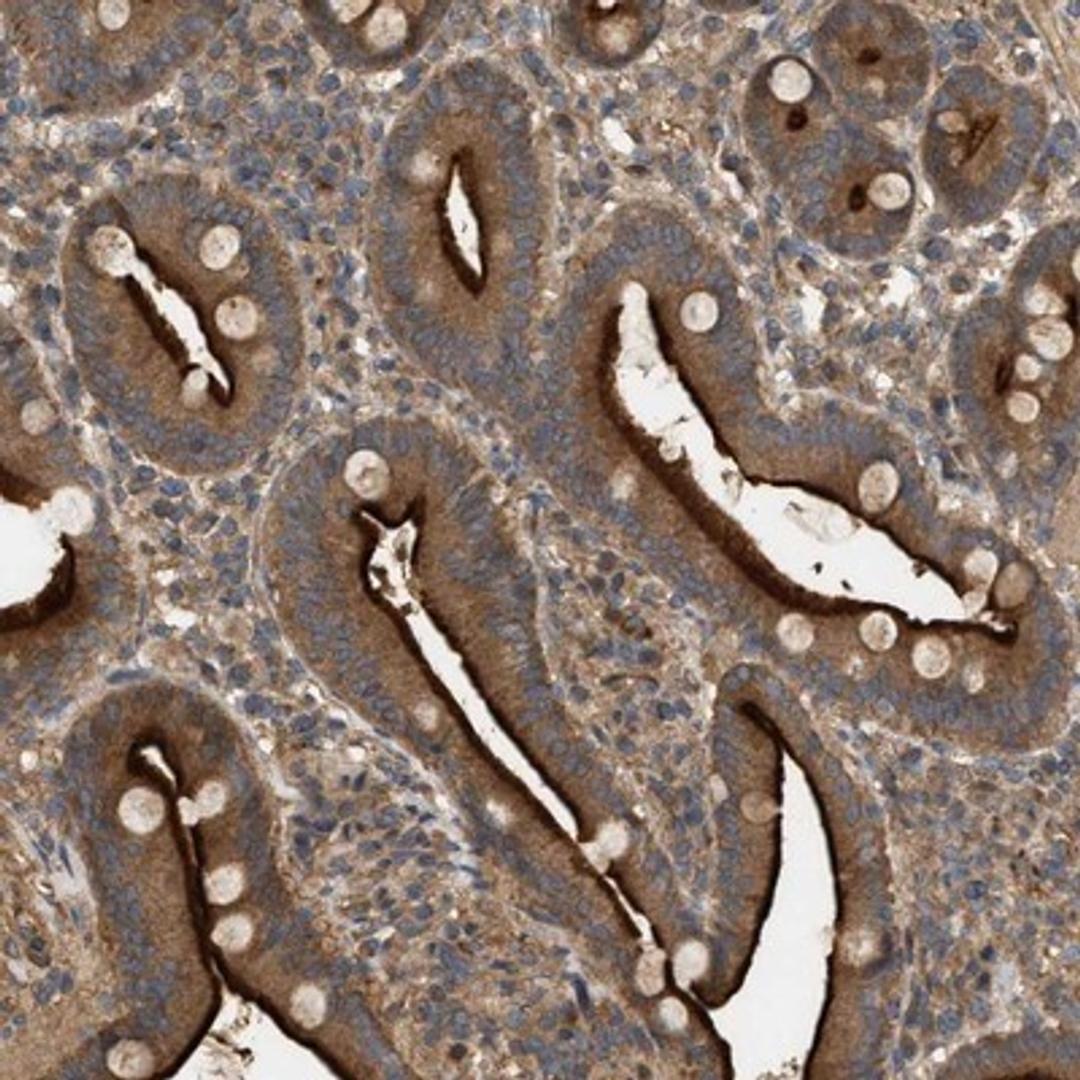 Immunohistochemistry-Paraffin: FAM71F1 Antibody [NBP1-83931] - Staining of human duodenum shows distinct cytoplasmic and membranous positivity in glandular cells.