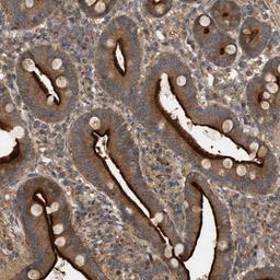 Immunohistochemistry-Paraffin: FAM71F1 Antibody [NBP1-83931] - Staining of human duodenum shows distinct cytoplasmic and membranous positivity in glandular cells.