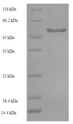 (Tris-Glycine gel) Discontinuous SDS-PAGE (reduced) with 5% enrichment gel and 15% separation gel.