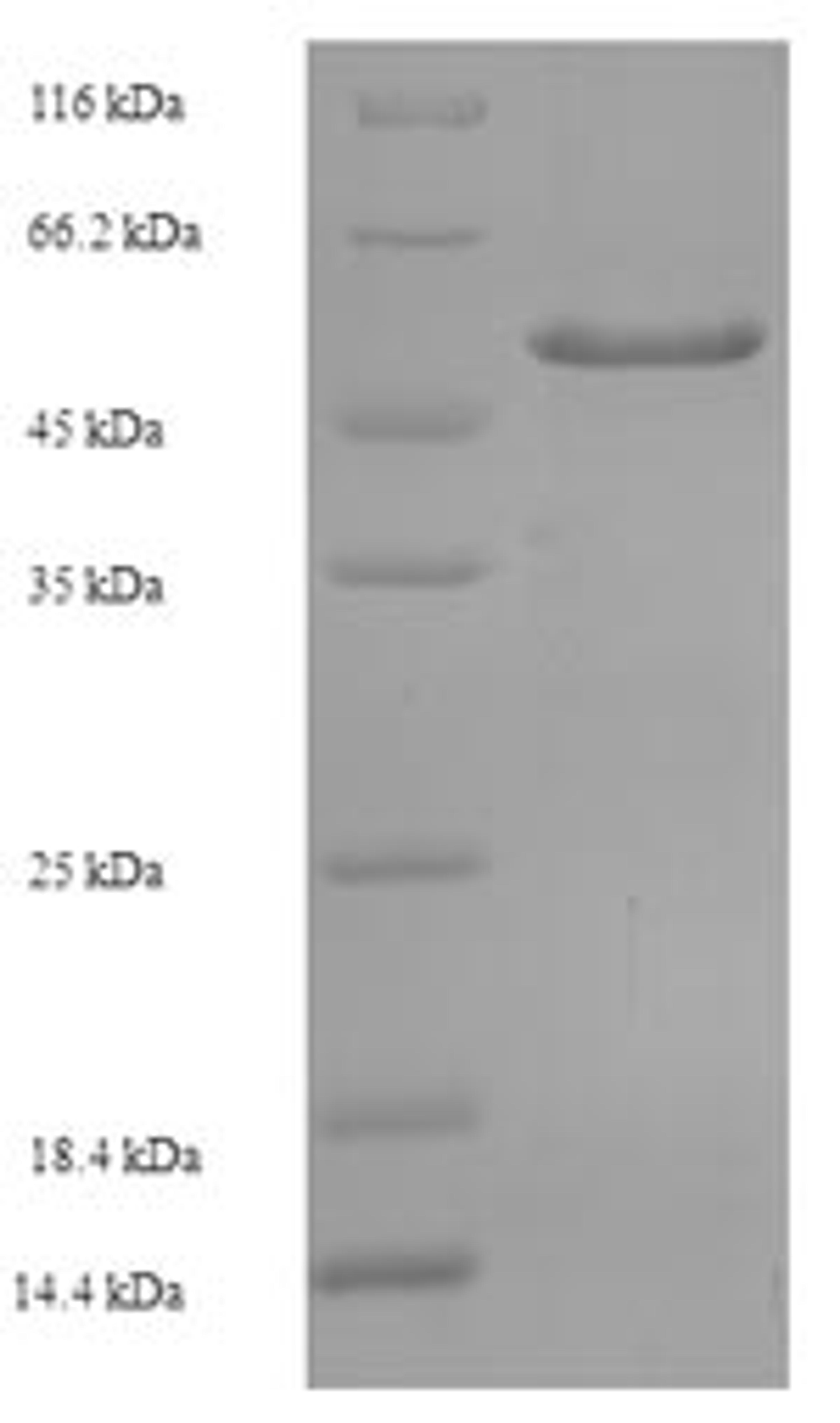(Tris-Glycine gel) Discontinuous SDS-PAGE (reduced) with 5% enrichment gel and 15% separation gel.