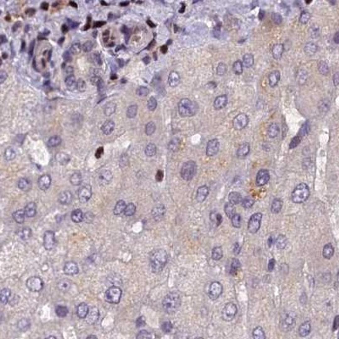 Immunohistochemistry: SP4 Antibody [NBP2-31983] - liver