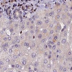 Immunohistochemistry: SP4 Antibody [NBP2-31983] - liver