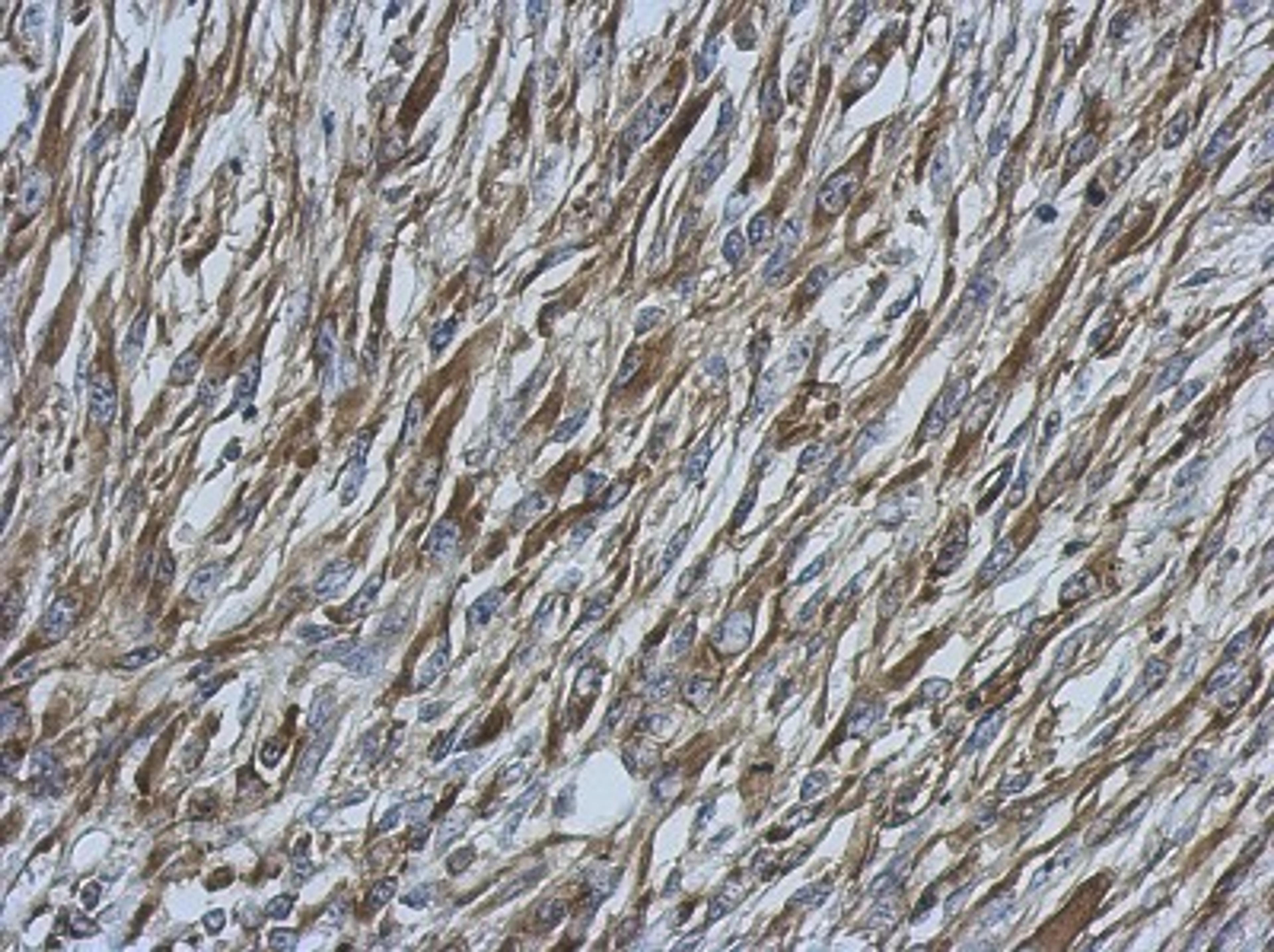 Immunohistochemistry-Paraffin: Ezrin Antibody [NBP2-16396] - Immunohistochemical analysis of paraffin-embedded C2C12 xenograft, using antibody at 1:500 dilution.