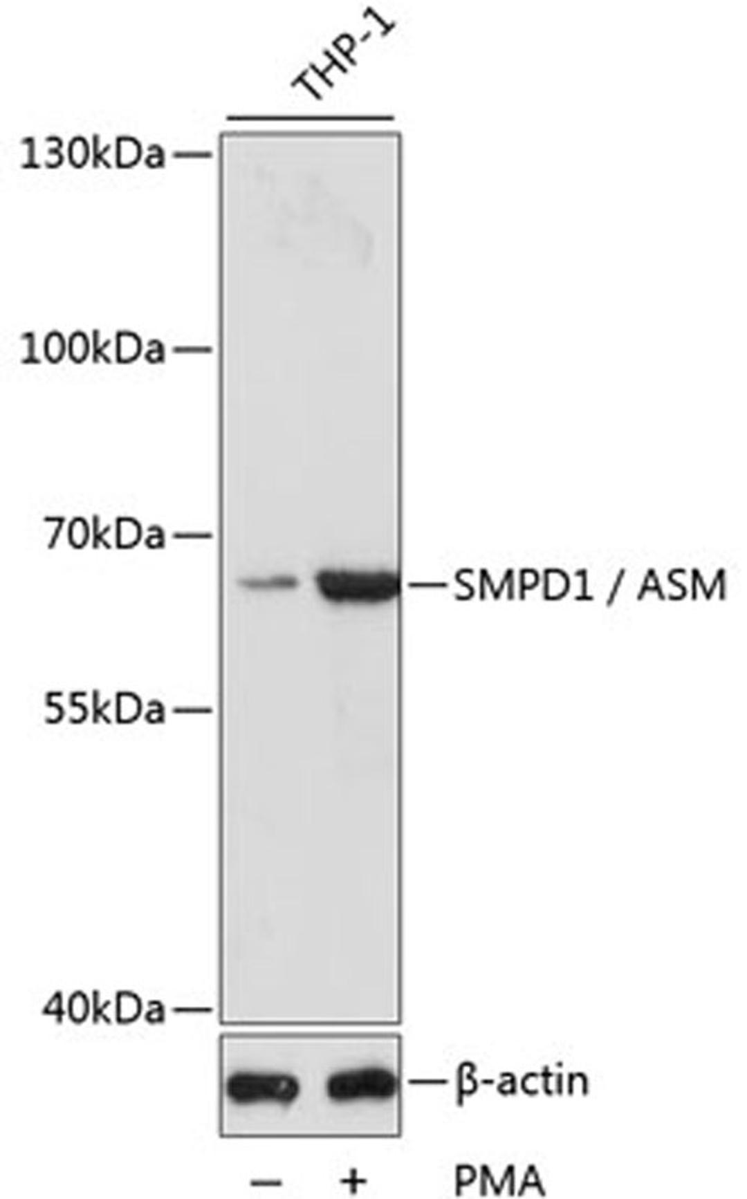 Western blot - SMPD1 / ASM antibody (A16263)