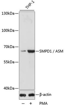 Western blot - SMPD1 / ASM antibody (A16263)