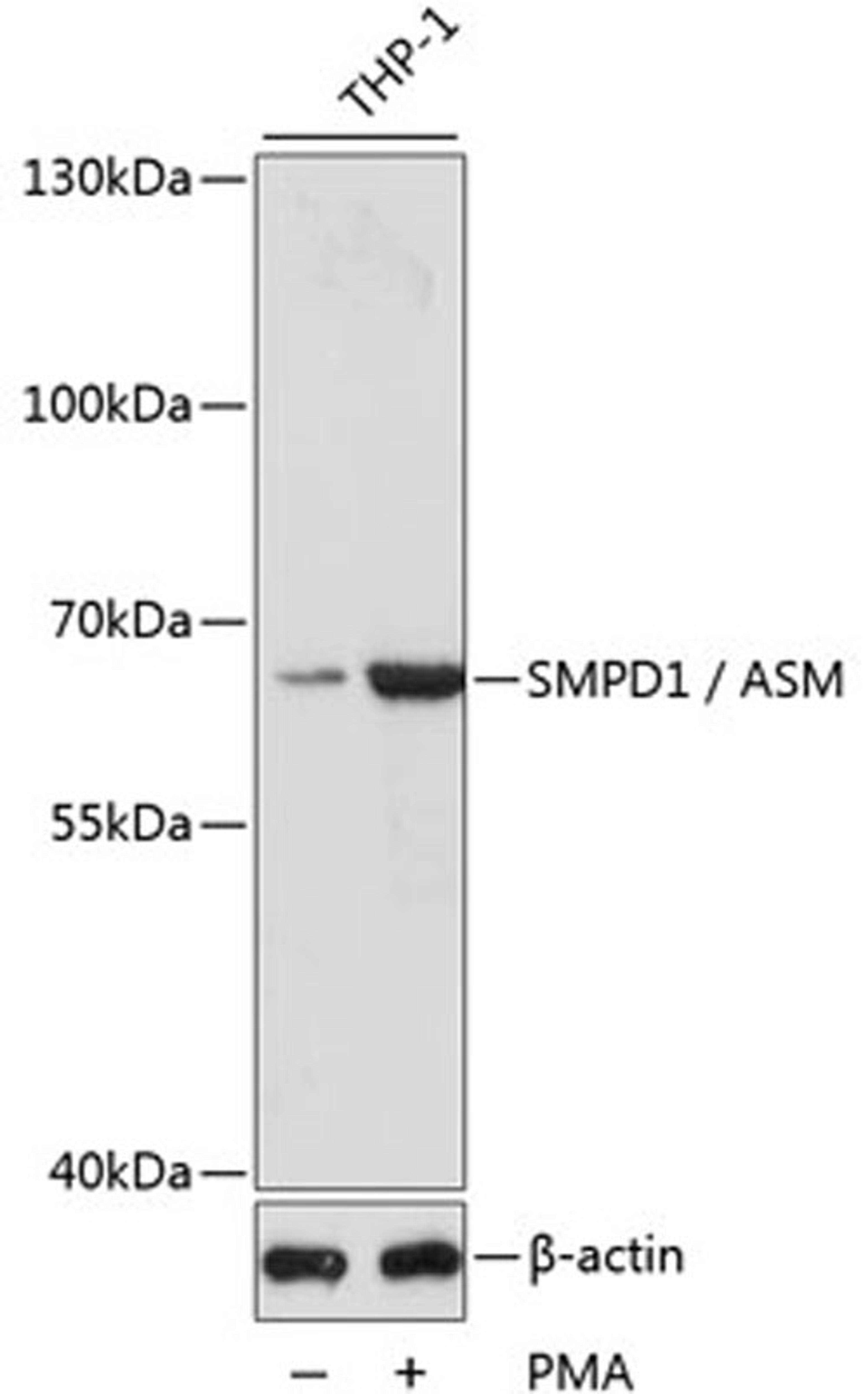 Western blot - SMPD1 / ASM antibody (A16263)