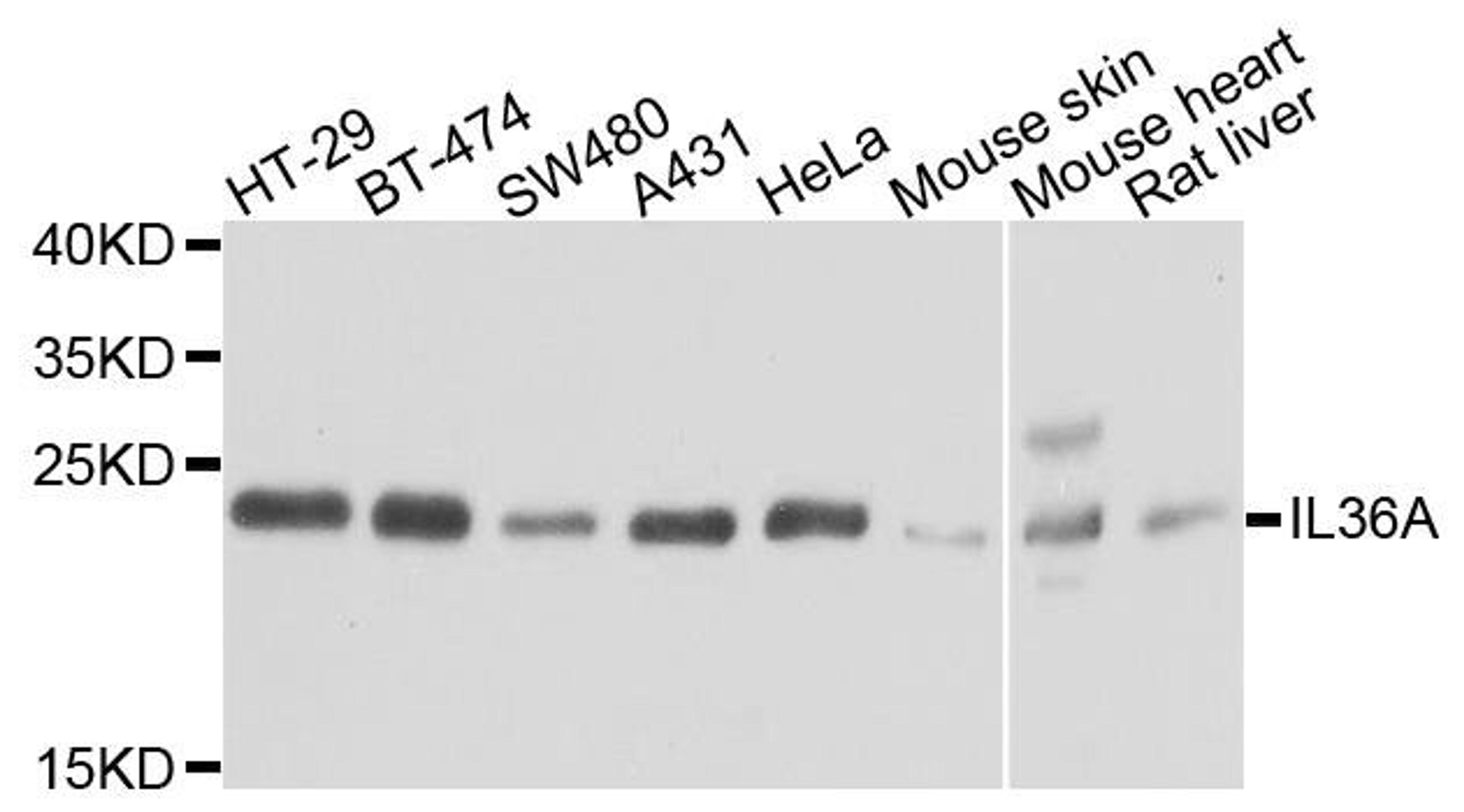 Western blot analysis of extracts of various cells using IL36A antibody