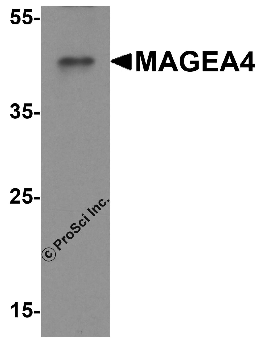 Western blot analysis of MAGEA4 in A431 cell lysate with MAGEA4 antibody at 1 &#956;g/ml.