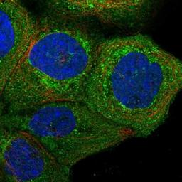 Immunocytochemistry/Immunofluorescence: METTL25 Antibody [NBP1-82105] - Staining of human cell line A-431 shows positivity in plasma membrane, cytoplasm & mitochondria.