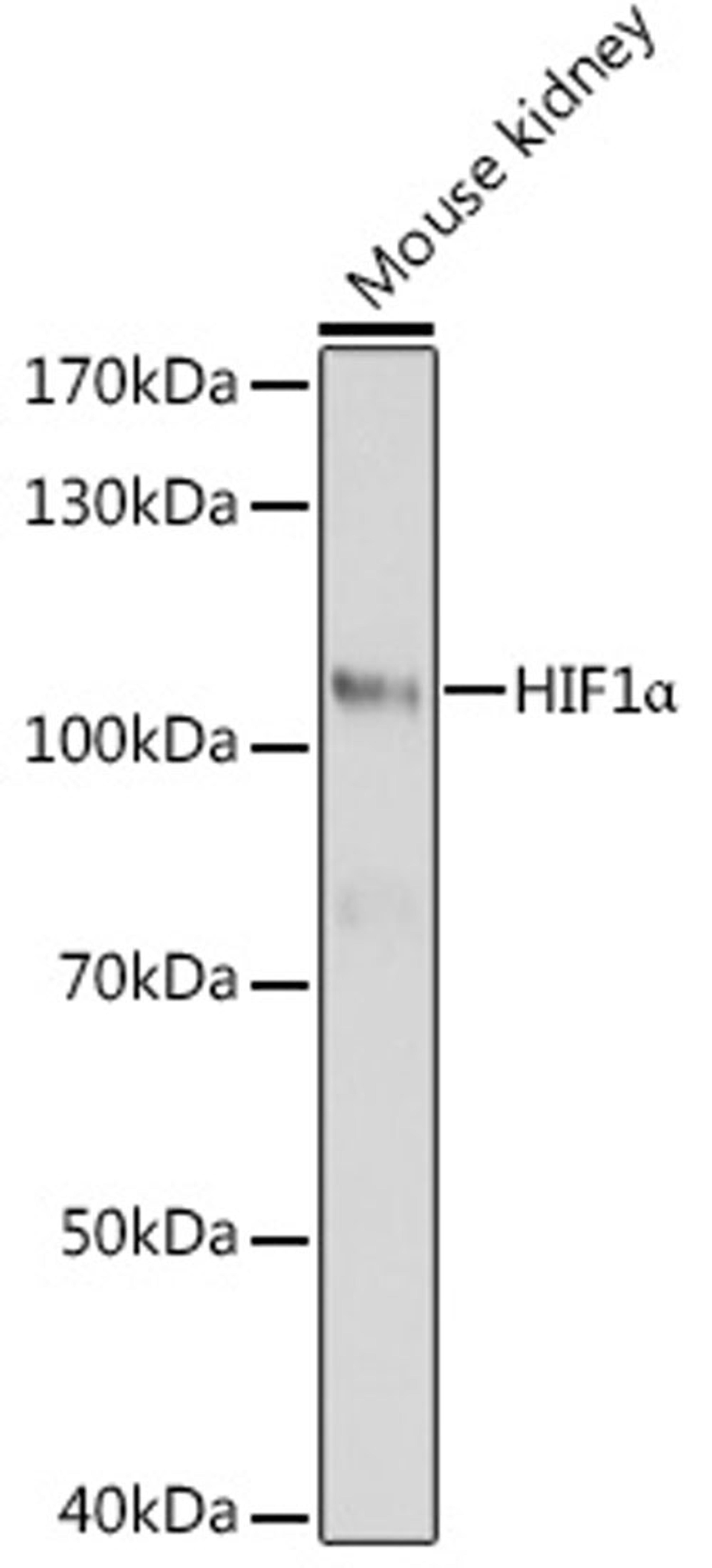 Western blot - HIF1a antibody (A16873)