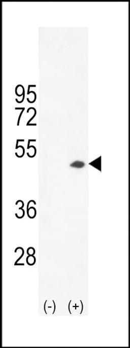 Western blot analysis of CKB using rabbit polyclonal CKB-C254 using 293 cell lysates (2 ug/lane) either nontransfected (Lane 1) or transiently transfected (Lane 2) with the CKB gene.