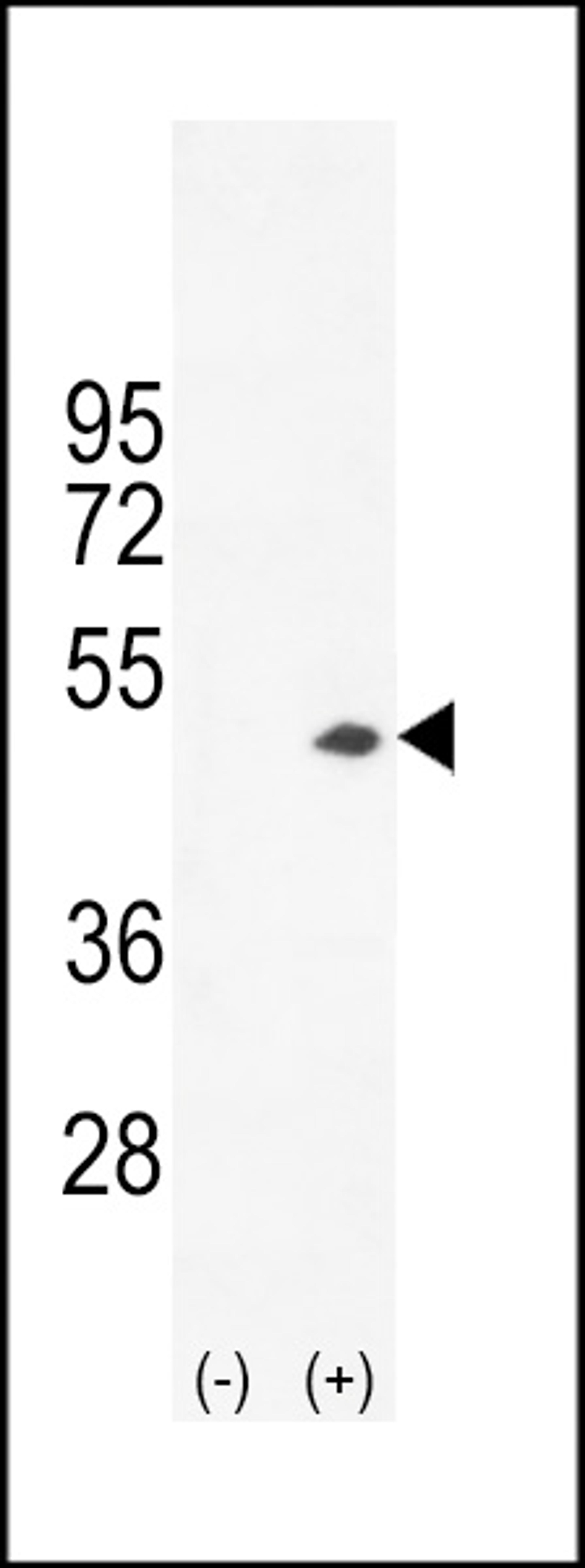 Western blot analysis of CKB using rabbit polyclonal CKB-C254 using 293 cell lysates (2 ug/lane) either nontransfected (Lane 1) or transiently transfected (Lane 2) with the CKB gene.