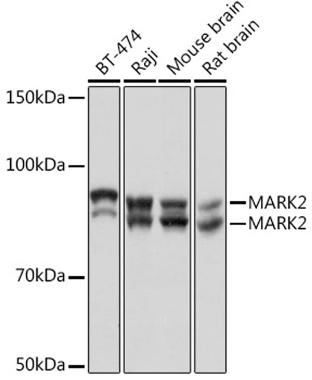 Western blot - MARK2 Rabbit mAb (A6512)