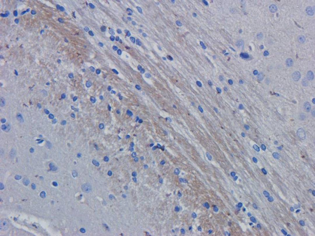 IHC-P image of rat brain tissue using anti-ROR1 (dilution of primary antibody at 2.5 ug/ml)