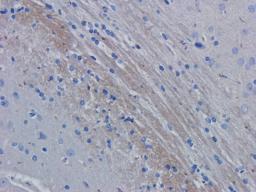 IHC-P image of rat brain tissue using anti-ROR1 (dilution of primary antibody at 2.5 ug/ml)