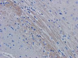 IHC-P image of rat brain tissue using anti-ROR1 (dilution of primary antibody at 2.5 ug/ml)