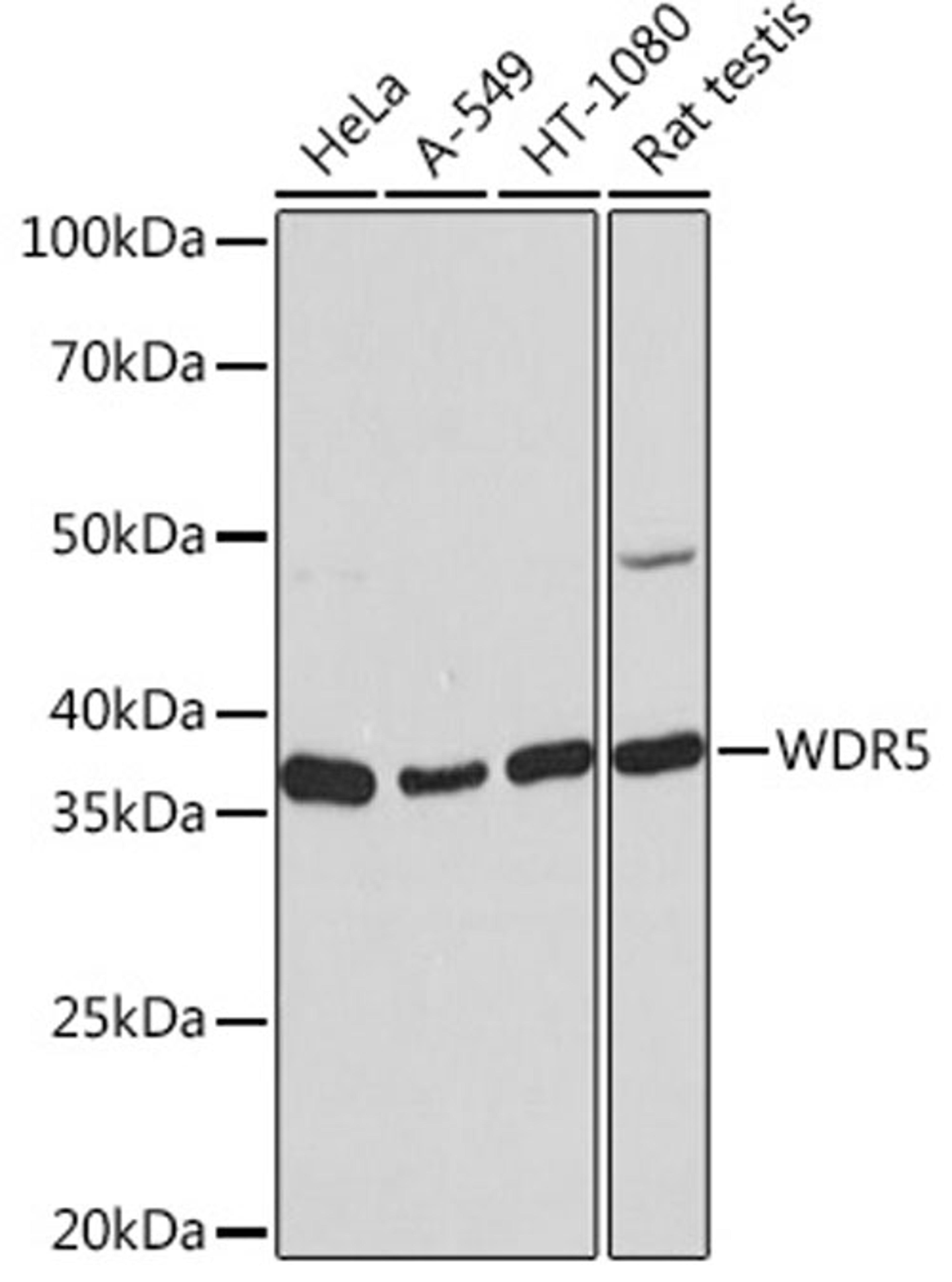 Western blot - WDR5 Rabbit mAb (A3259)