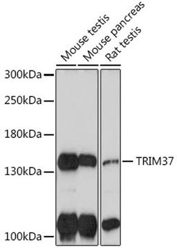 Western blot - TRIM37 antibody (A18307)