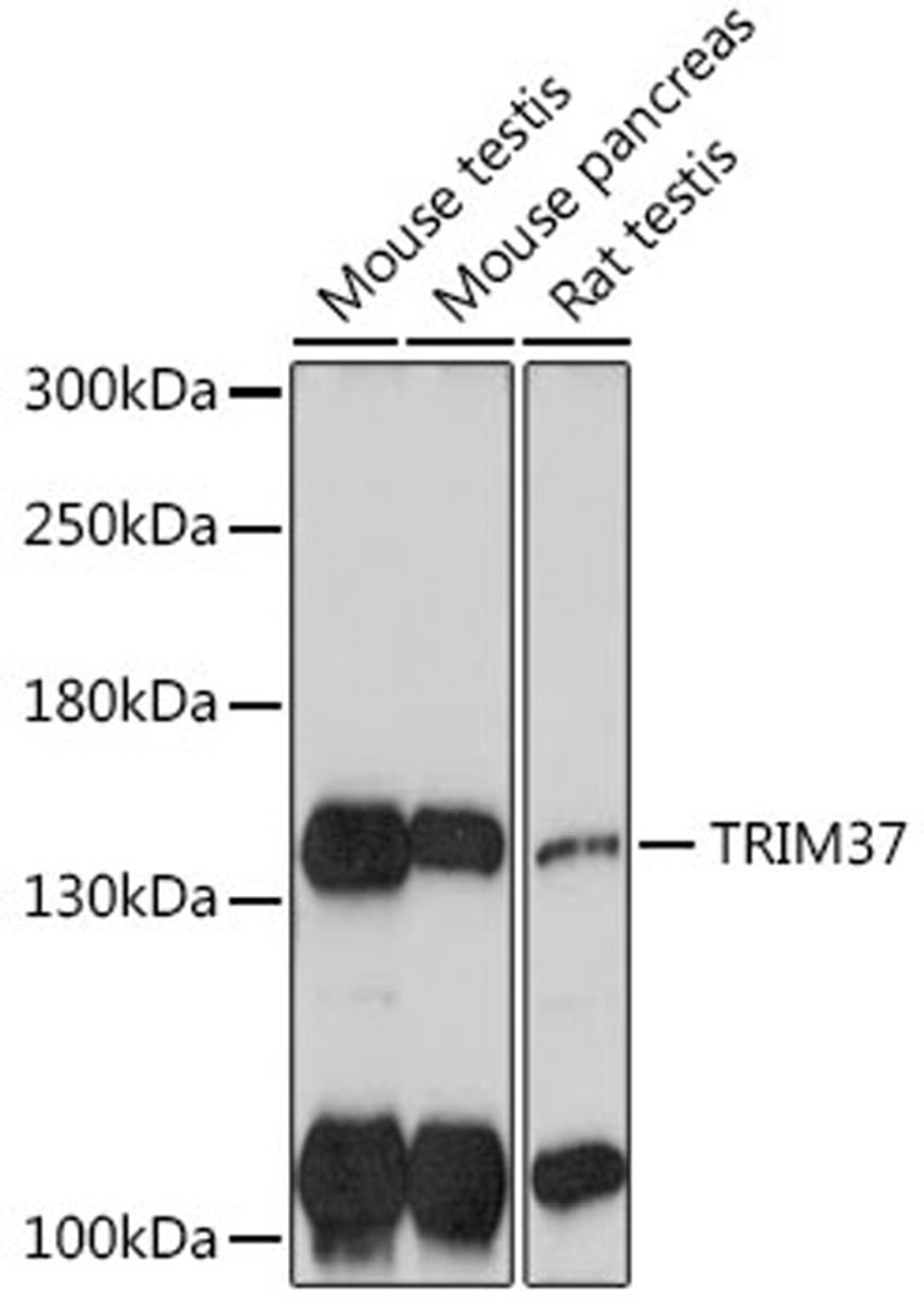 Western blot - TRIM37 antibody (A18307)