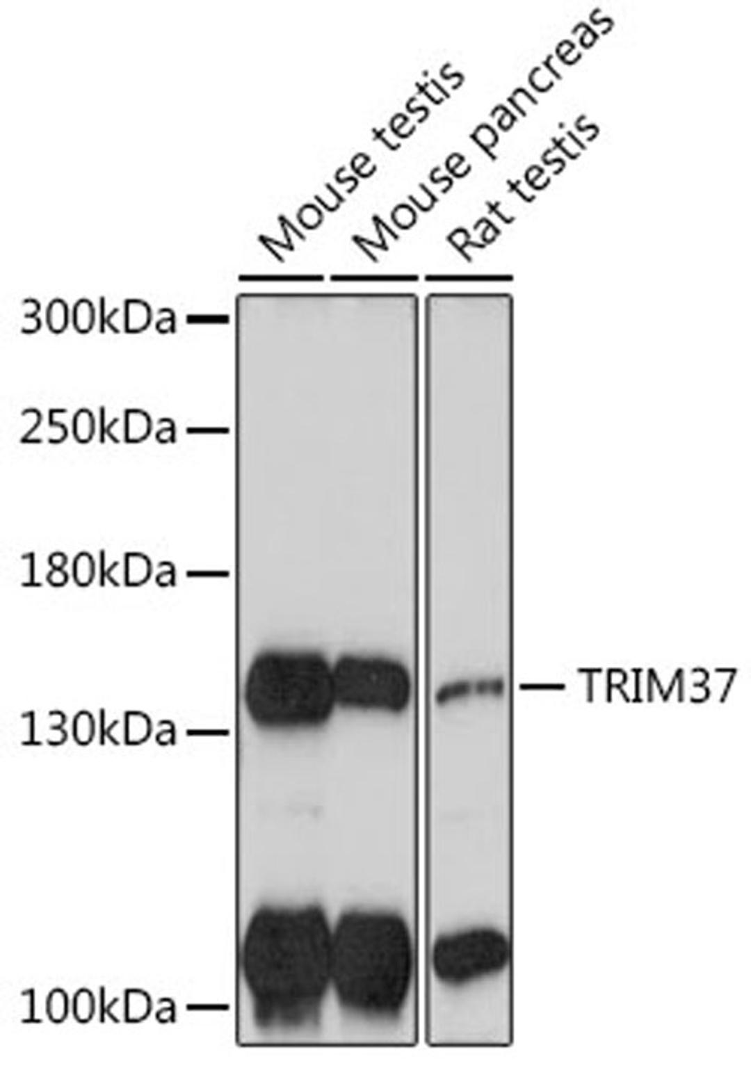 Western blot - TRIM37 antibody (A18307)