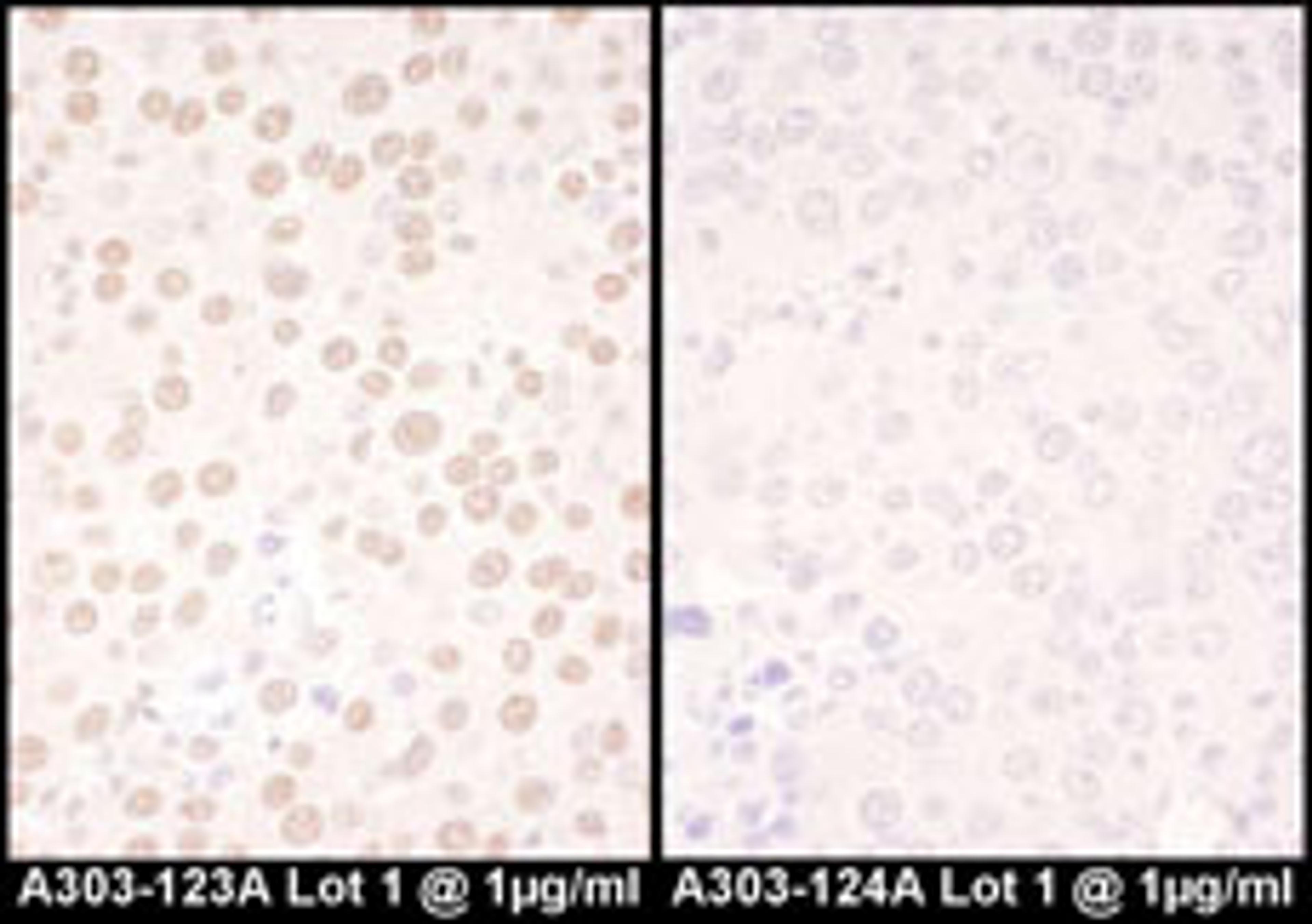 Detection of mouse NFIC by immunohistochemistry.