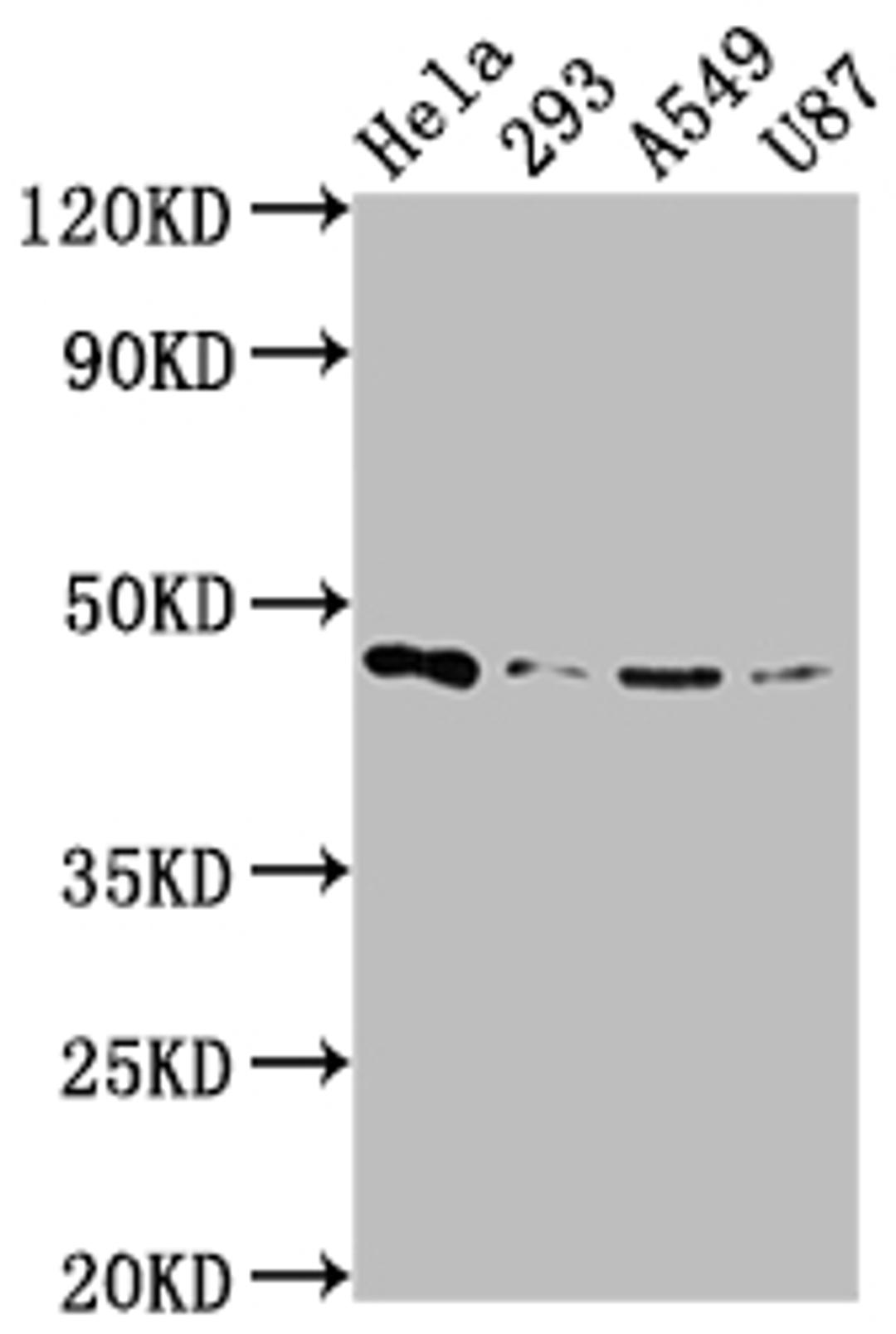 Western Blot. Positive WB detected in: Hela whole cell lysate, 293 whole cell lysate, A549 whole cell lysate, U87 whole cell lysate. All lanes: MAP2K1 antibody at 1:2000. Secondary. Goat polyclonal to rabbit IgG at 1/50000 dilution. Predicted band size: 44, 41 kDa. Observed band size: 44 kDa. 