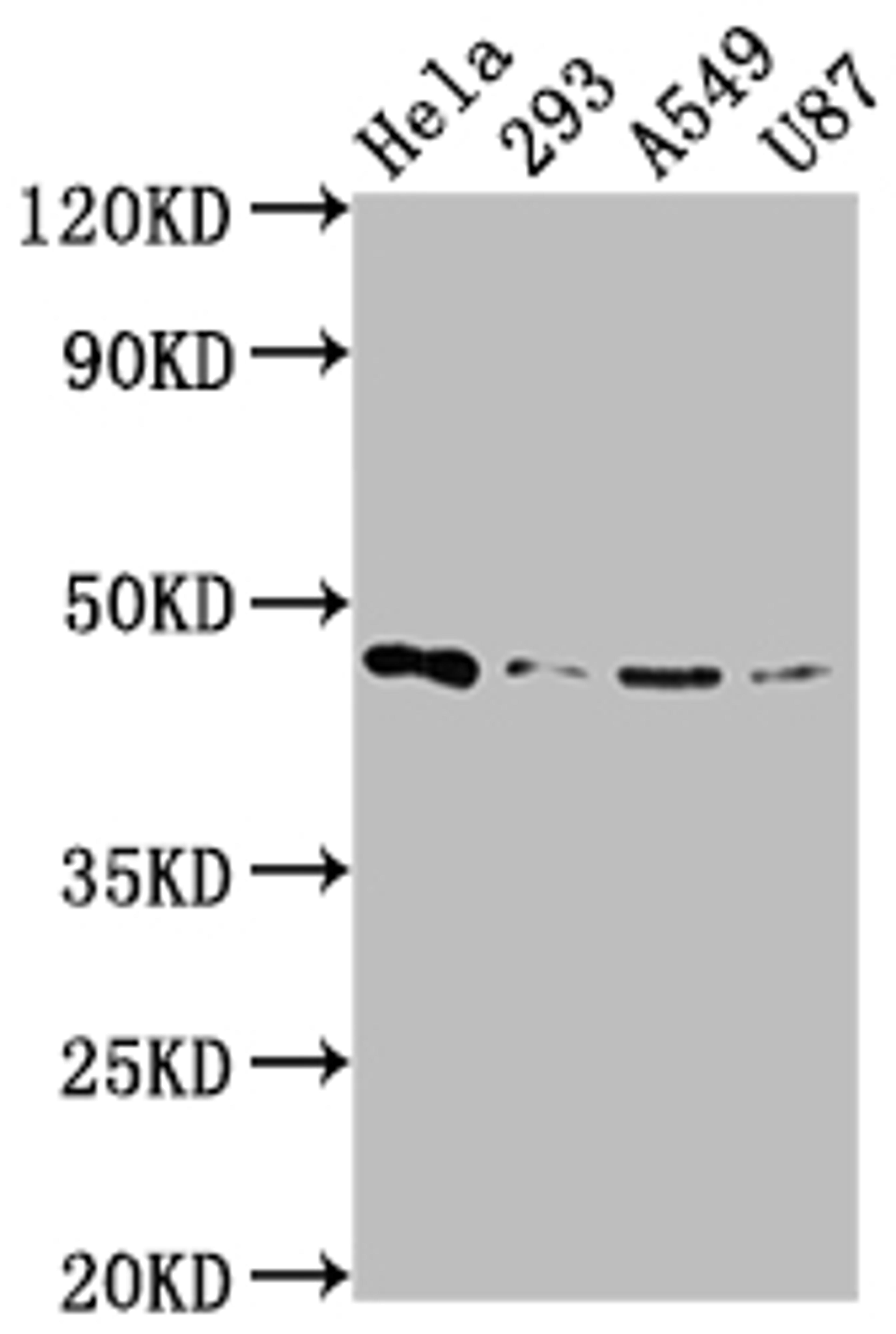 Western Blot. Positive WB detected in: Hela whole cell lysate, 293 whole cell lysate, A549 whole cell lysate, U87 whole cell lysate. All lanes: MAP2K1 antibody at 1:2000. Secondary. Goat polyclonal to rabbit IgG at 1/50000 dilution. Predicted band size: 44, 41 kDa. Observed band size: 44 kDa. 