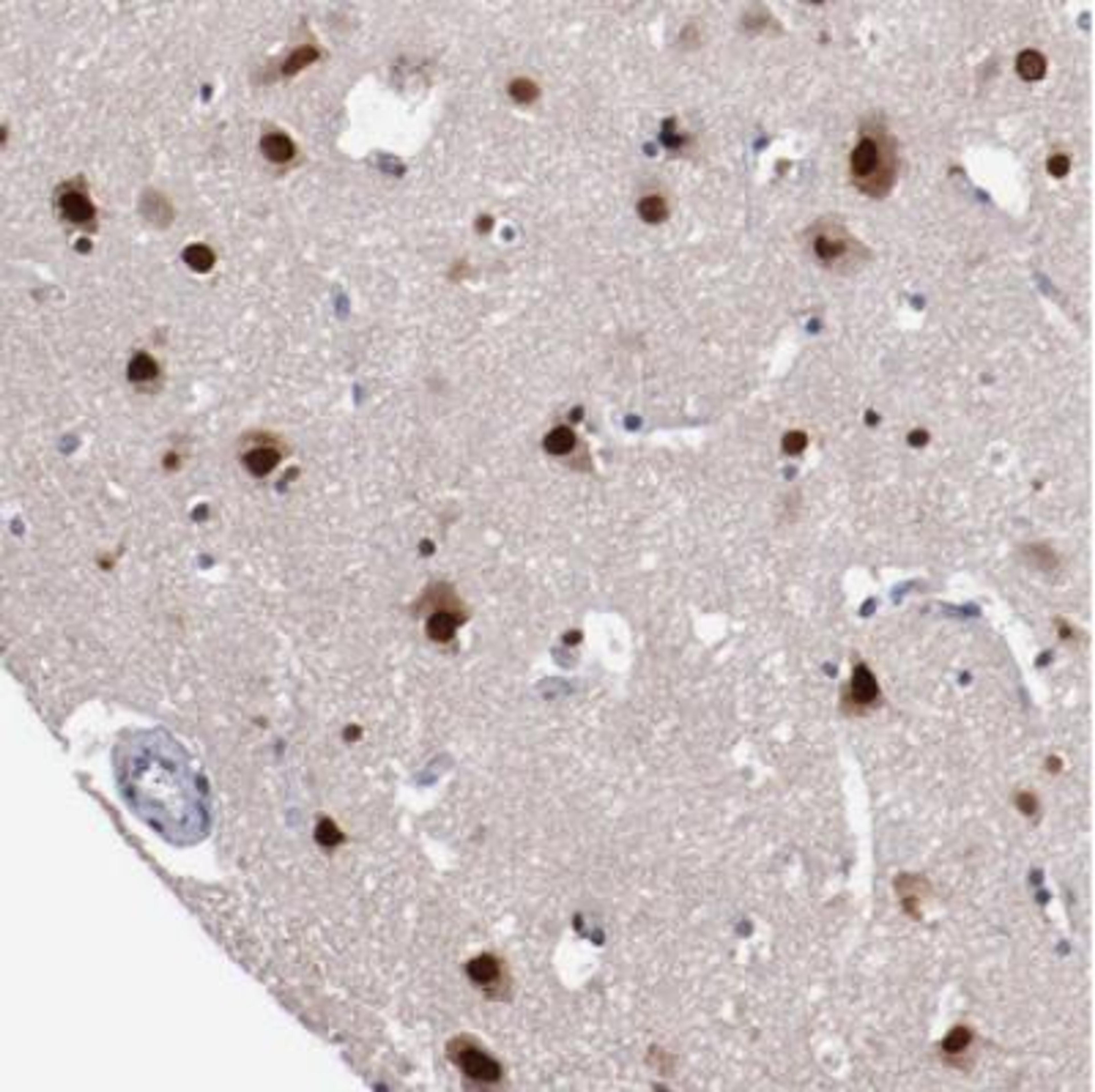 Immunohistochemistry: FAM81A Antibody [NBP2-33295] - Immunohistochemical staining of human cerebral cortex shows strong nuclear and cytoplasmic positivity in neuronal cells and strong nuclear positivity in glial cells.