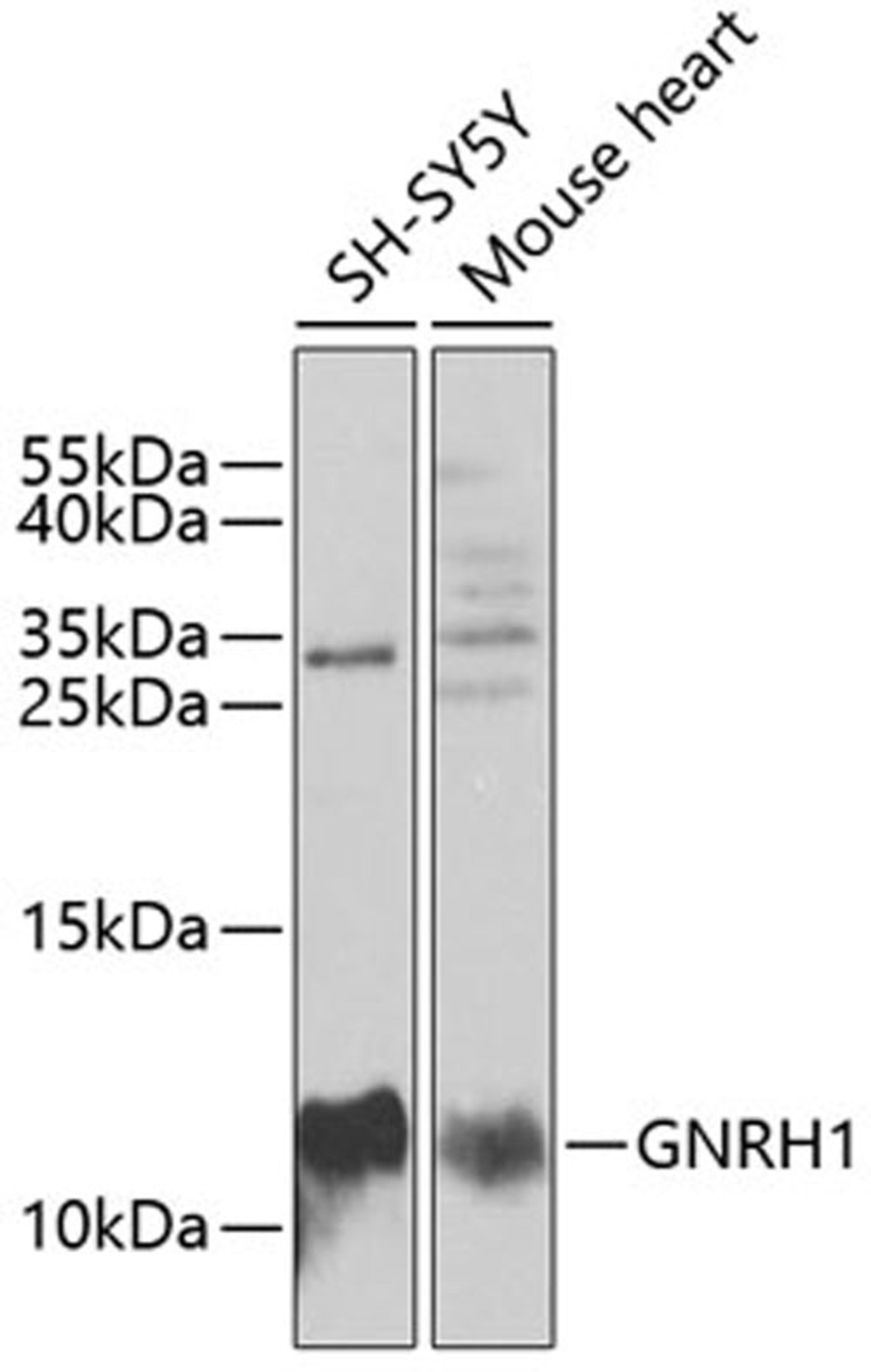 Western blot - GNRH1 antibody (A5625)