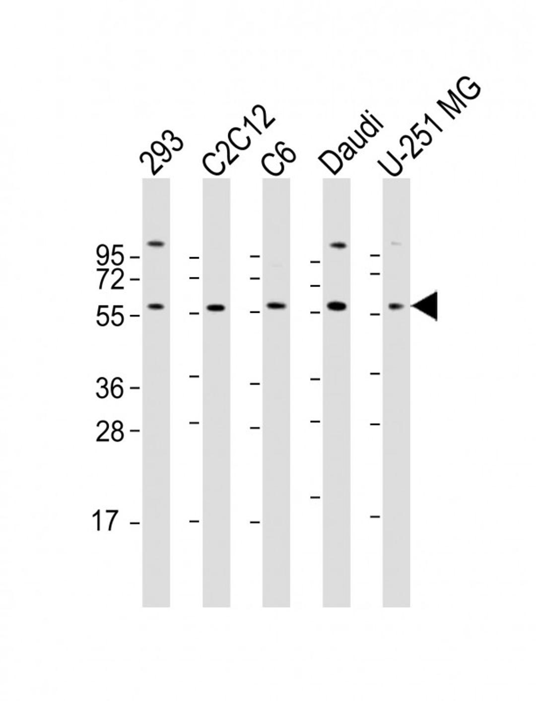 Western Blot at 1:2000 dilution Lane 1: 293 whole cell lysate Lane 2: C2C12 whole cell lysate Lane 3: C6 whole cell lysate Lane 4: Daudi whole cell lysate Lane 5: U-251 MG whole cell lysate Lysates/proteins at 20 ug per lane.