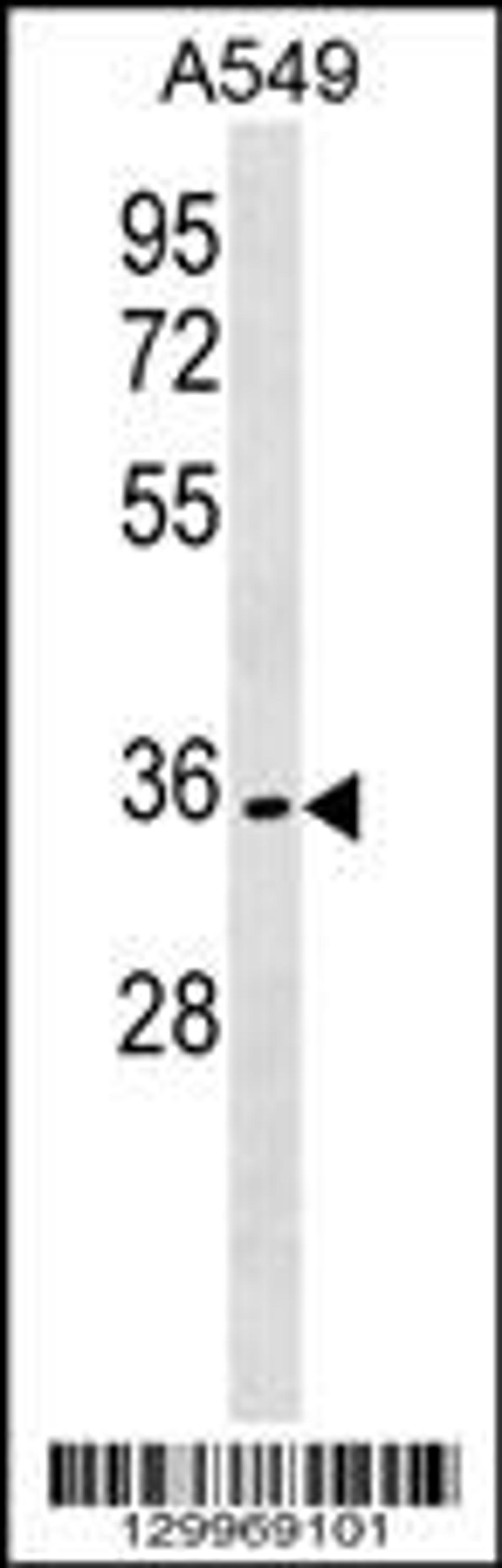 Western blot analysis in A549 cell line lysates (35ug/lane).