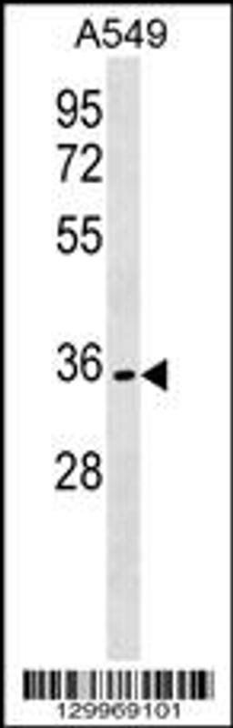 Western blot analysis in A549 cell line lysates (35ug/lane).