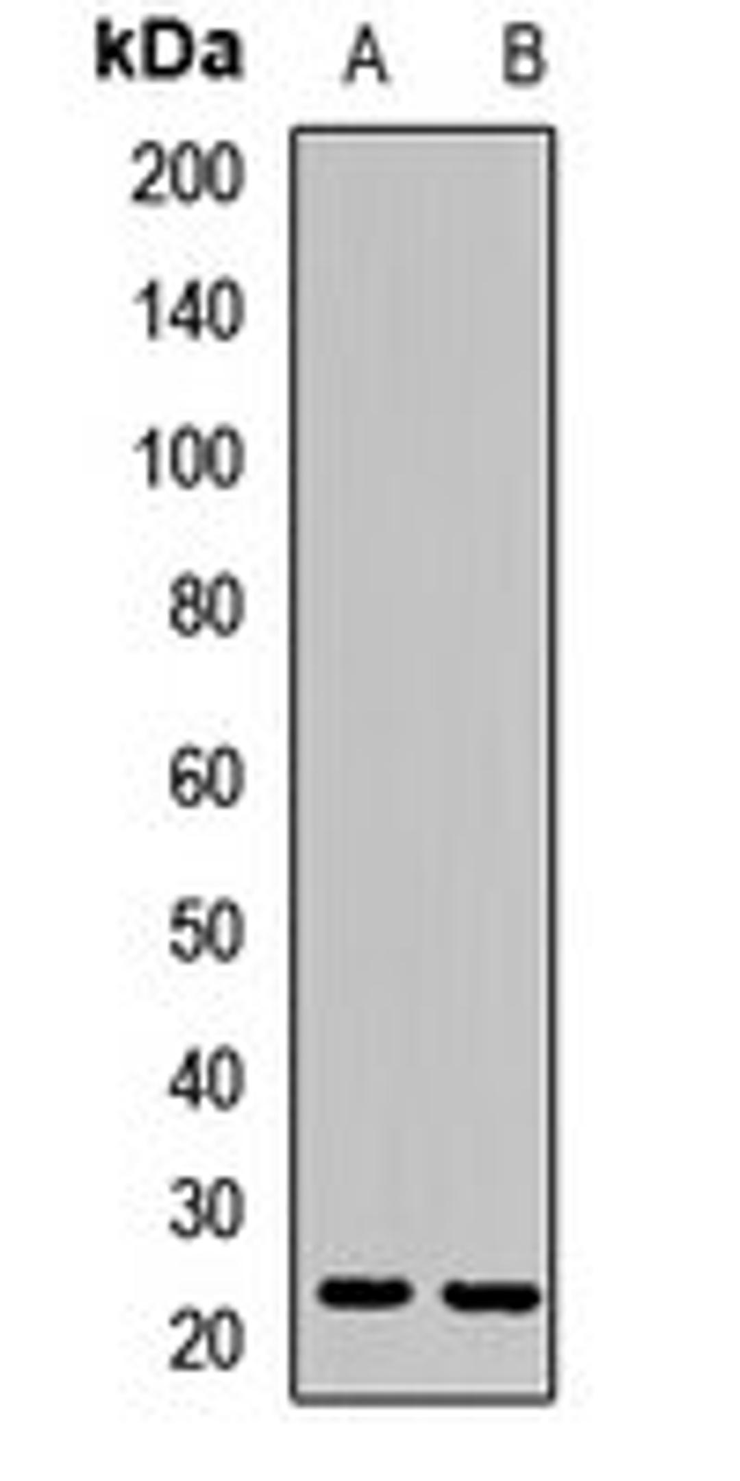 Western blot analysis of HepG2 (Lane1), mouse stomach (Lane2) whole cell lysates using VBP1 antibody