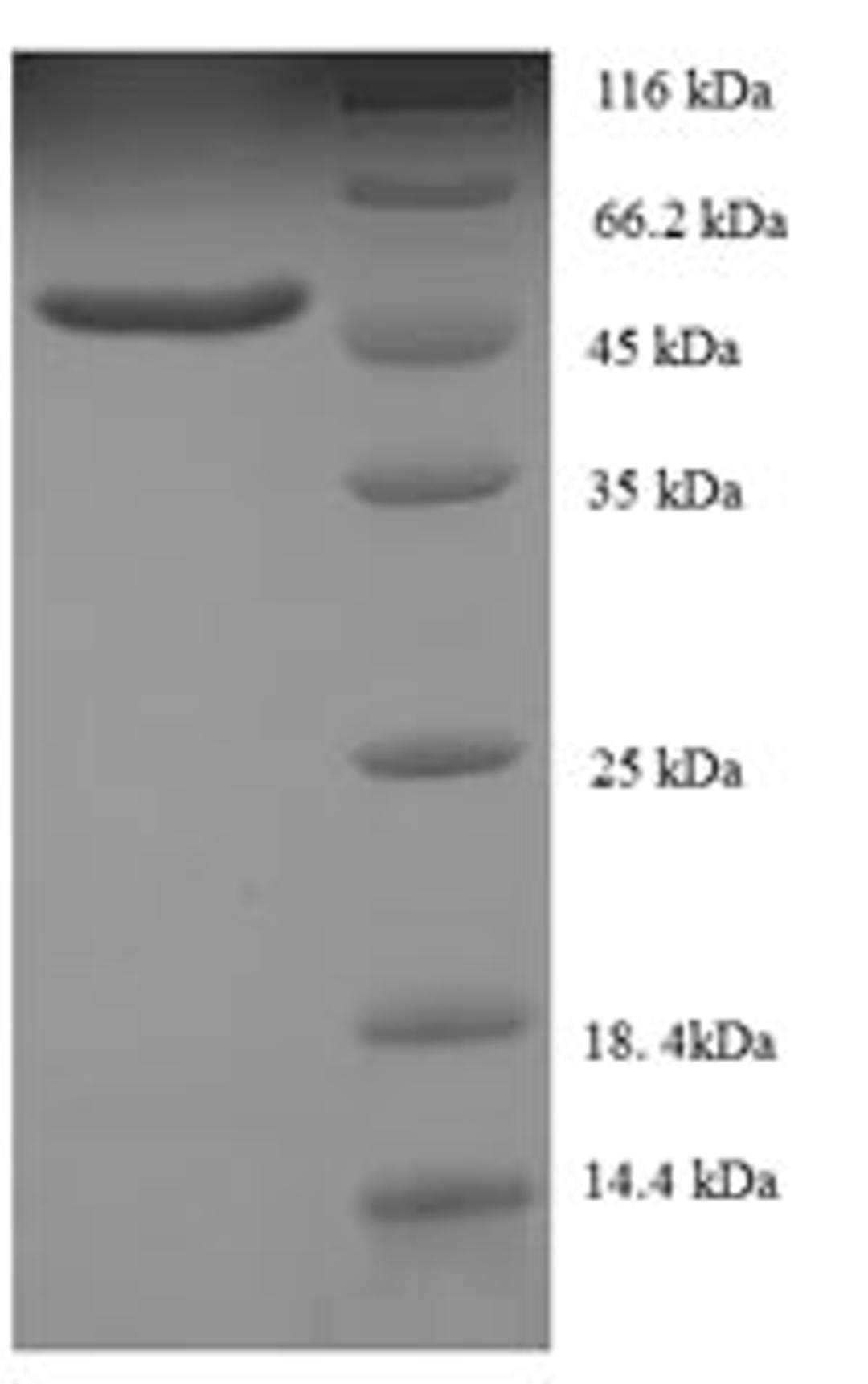 (Tris-Glycine gel) Discontinuous SDS-PAGE (reduced) with 5% enrichment gel and 15% separation gel.