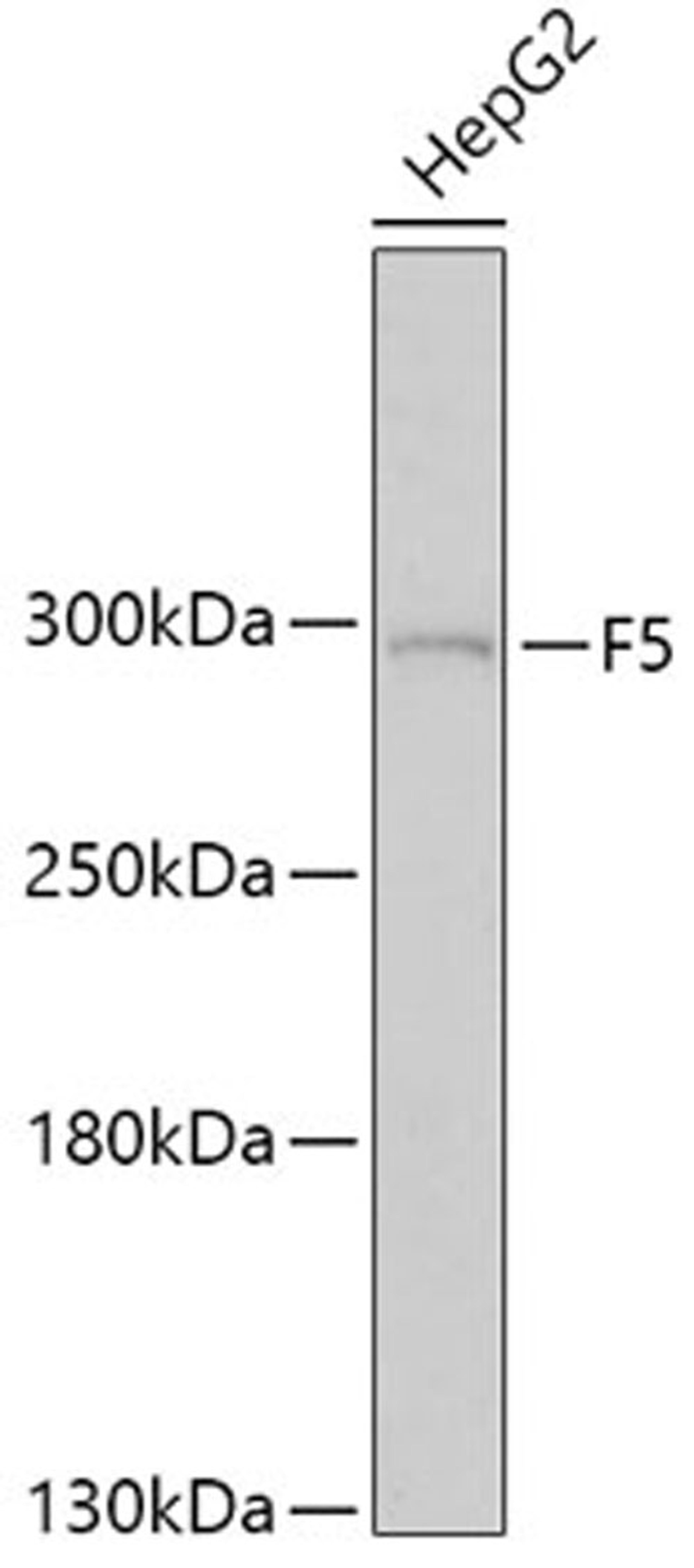 Western blot - F5 antibody (A1292)