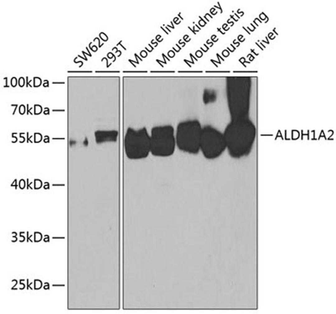 Western blot - ALDH1A2 antibody (A7503)