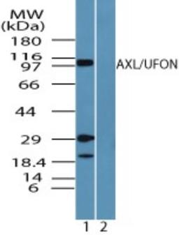 Western Blot: Axl Antibody [NBP2-24497] - Analysis of AXL in HUVEC cell lysate in the 1) absence and 2) presence of immunizing peptide using NBP2-24497 at 0.5 ug/ml.