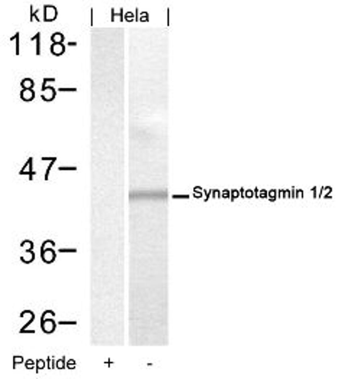 Western blot analysis of lysed extracts from HeLa cells using Synaptotagmin 1/2 (Ab-202/199).