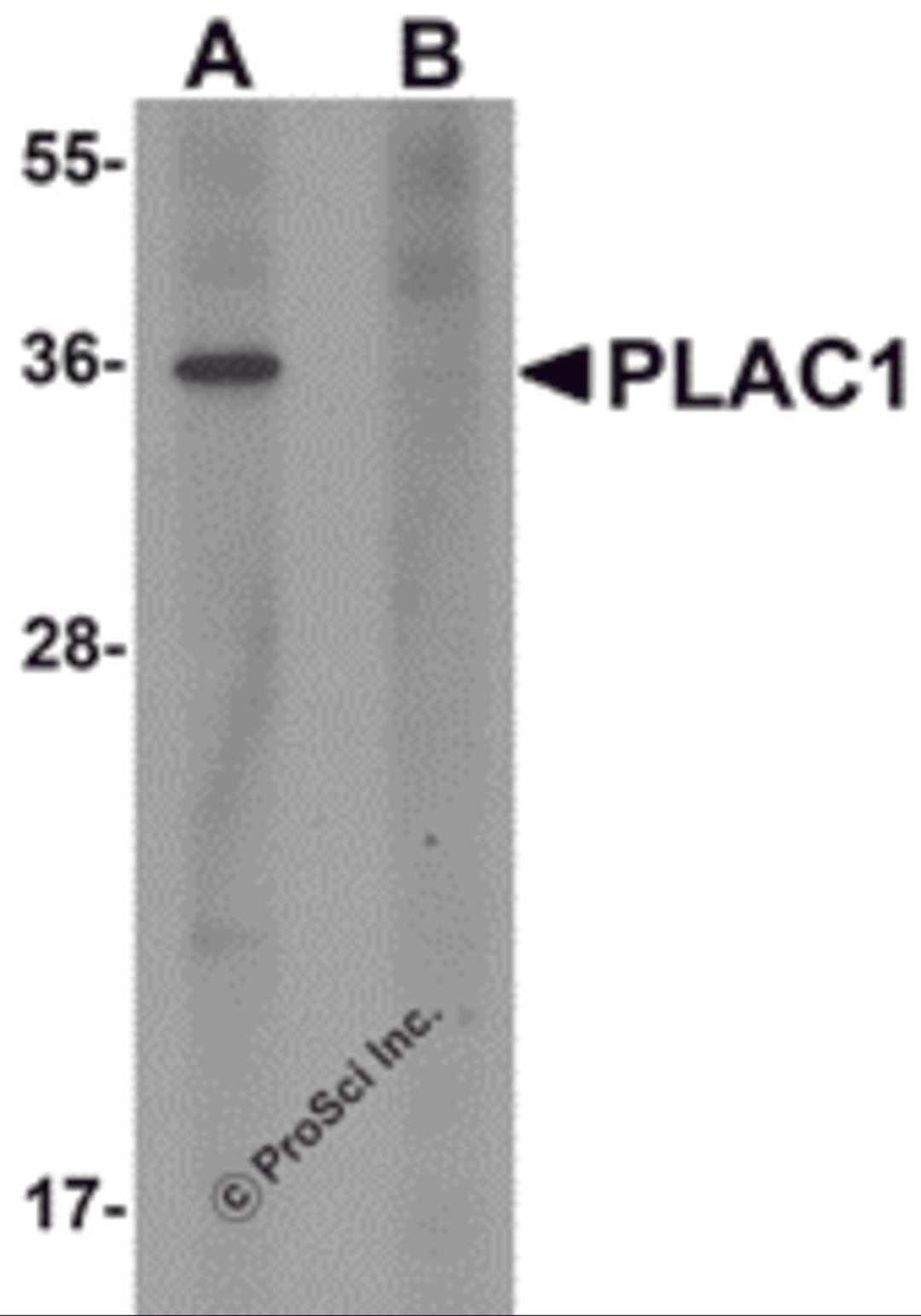 Western blot analysis of PLAC1 in human placenta tissue lysate with PLAC1 antibody at 1 μg/mL in (A) the absence and (B) the presence of blocking peptide.