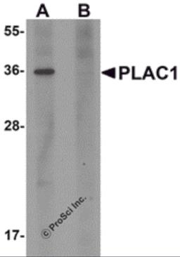 Western blot analysis of PLAC1 in human placenta tissue lysate with PLAC1 antibody at 1 μg/mL in (A) the absence and (B) the presence of blocking peptide.