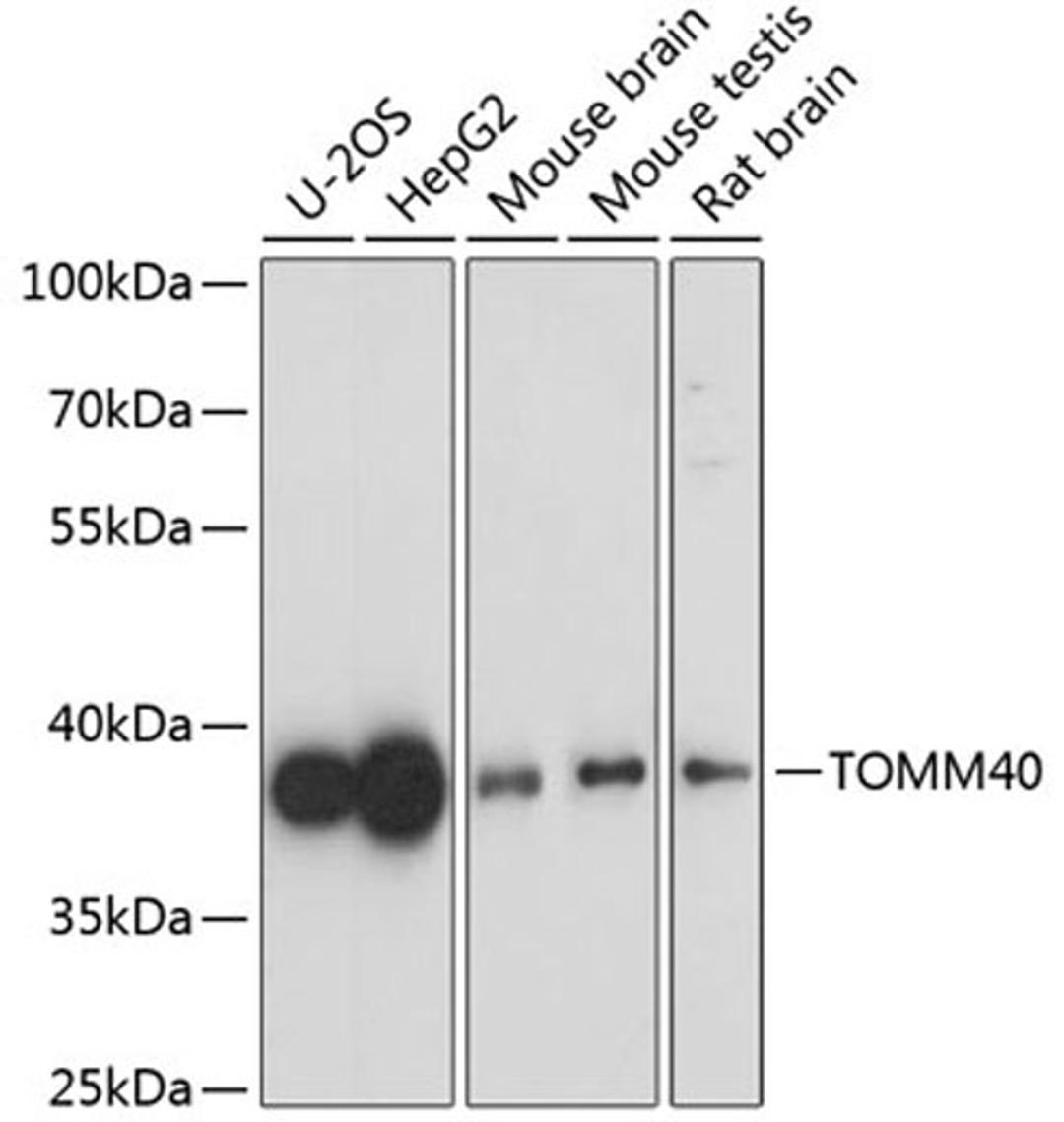 Western blot - TOMM40 antibody (A3213)