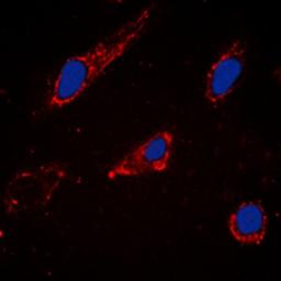 Immunofluorescense analysis of Hela cells using Cytochrome (phospho-450 2C19) antibody