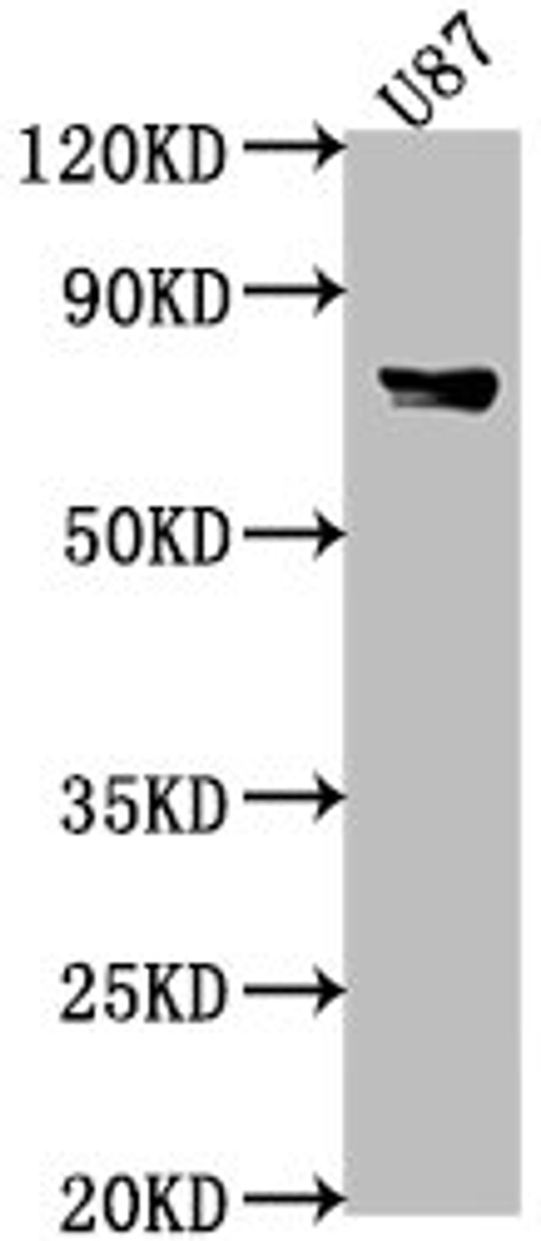 Western Blot. Positive WB detected in: U87 whole cell lysate, Mouse heart tissue. All lanes: FEM1B antibody at 1:2000. Secondary. Goat polyclonal to rabbit IgG at 1/50000 dilution. Predicted band size: 71 kDa. Observed band size: 71 kDa. 