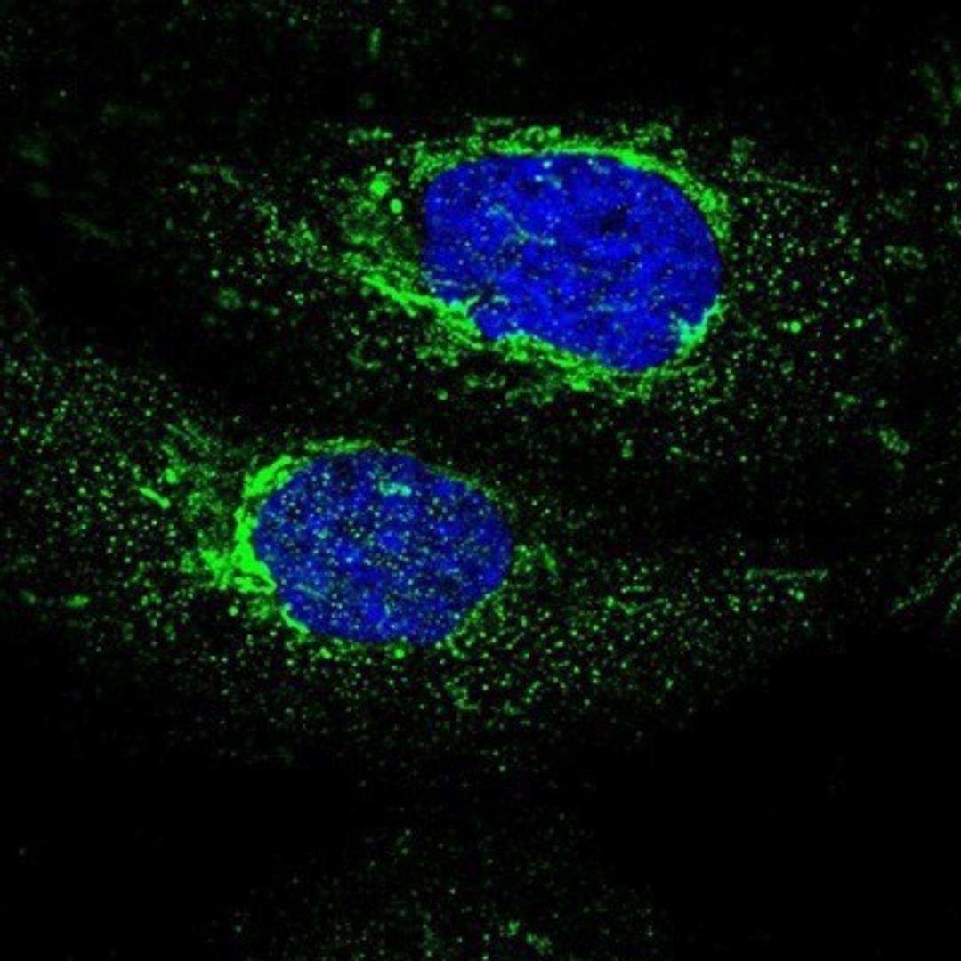 Immunocytochemistry/Immunofluorescence: MECR Antibody [NBP1-85657] - Staining of human cell line A-431 shows positivity in mitochondria.